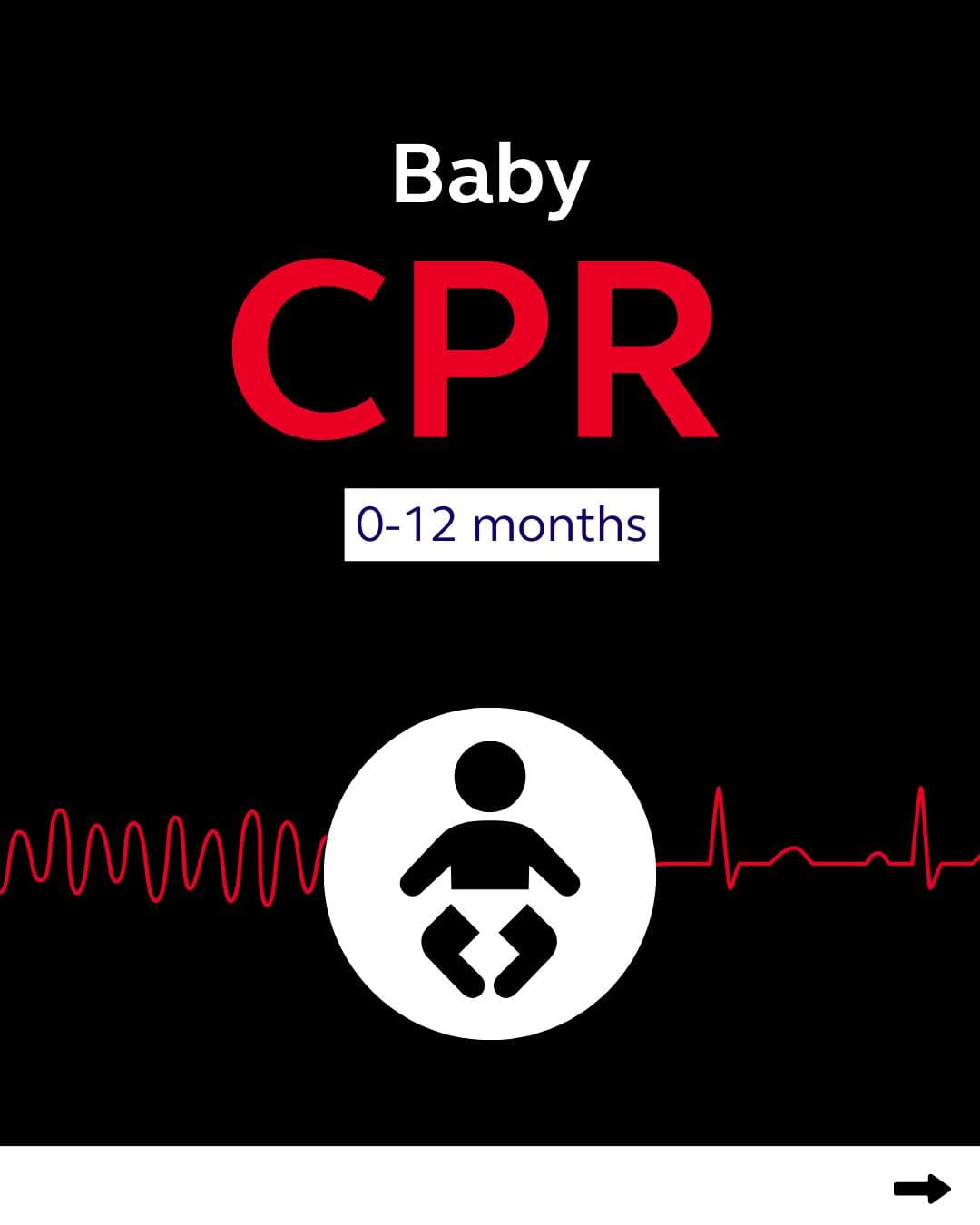 КПР при бебета